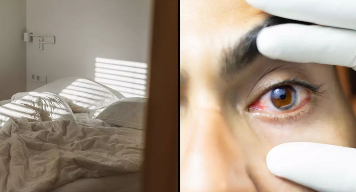 Can You Get Pink Eye from Farting on a Pillow? Myths, Facts, and Science 2 can-you-get-pink-eye-from-farting-on-a-pillow
