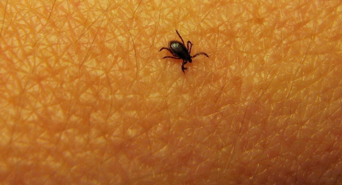 Feeling That Something Is Crawling on Skin – Treatment & Relief Tips 2 feeling-that-something-is-crawling-on-skin