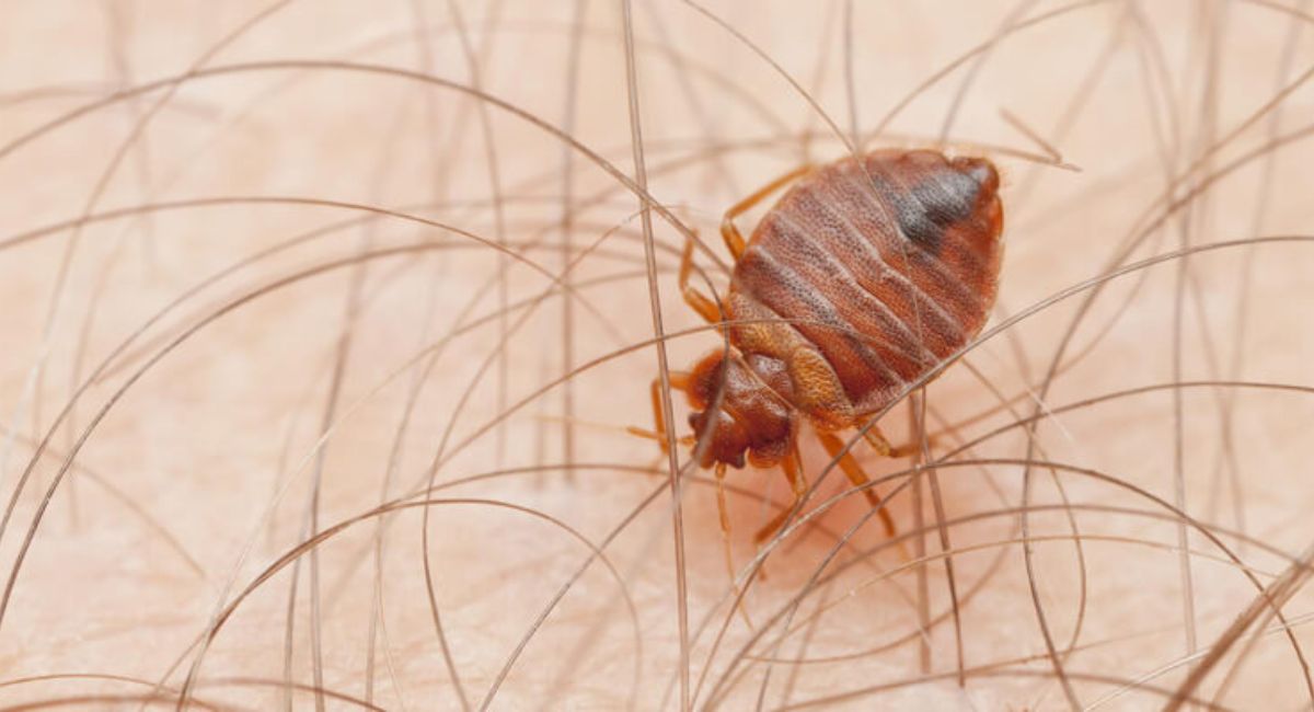 Can Bed Bugs Live in Your Hair? Experts Reveal the Truth You Need to Know 1 bed-bugs-live-in-hair