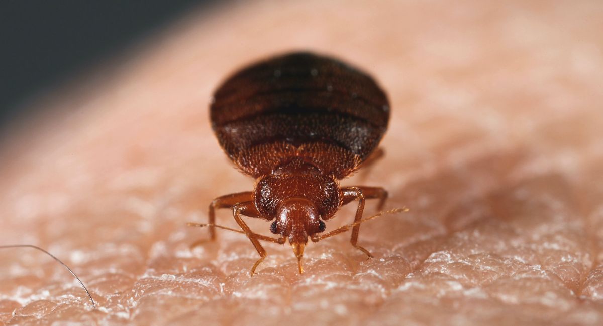 Natural Remedies for Bug Bites That Instantly Soothe Itching and Swelling 1 bug-bites