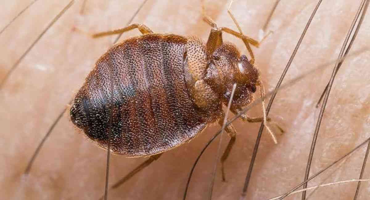 Can Bed Bugs Live in Your Hair? Experts Reveal the Truth You Need to Know 3 how-to-remove-bed-bugs-from-hair