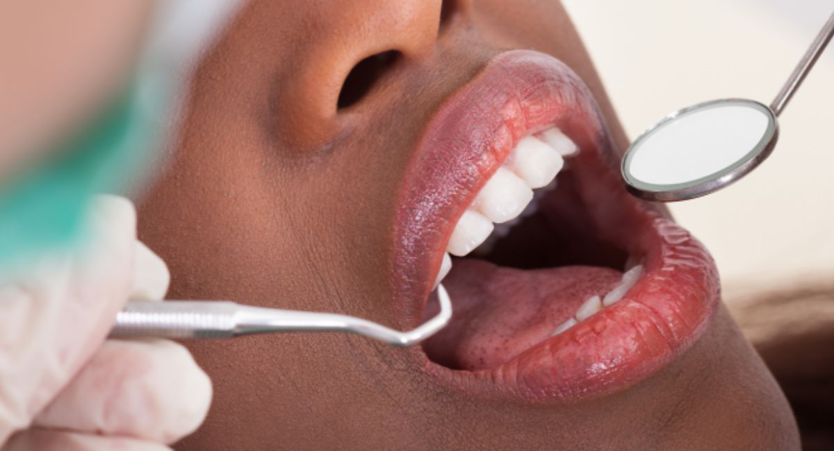 Can Wisdom Teeth Grow Back? The Truth Dentists Want You to Know 4 visit-dentist