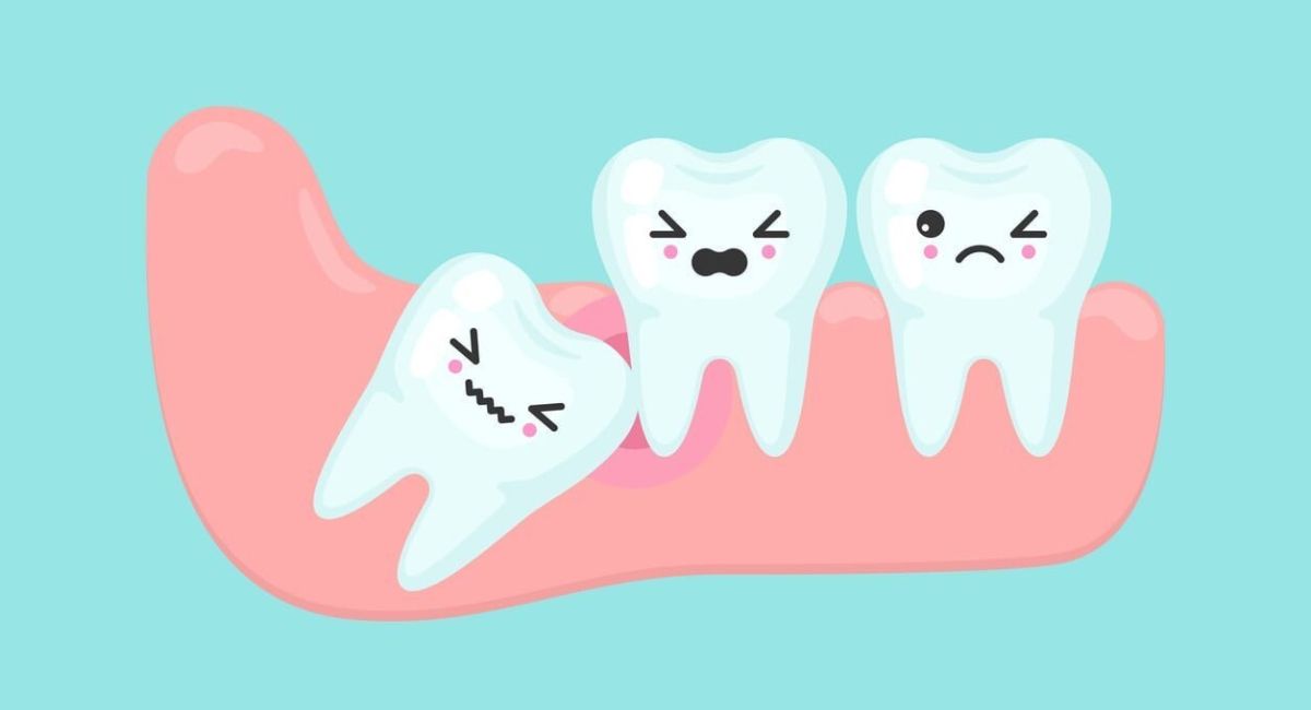 Can Wisdom Teeth Grow Back? The Truth Dentists Want You to Know 1 wisdom-teeth-grow-back