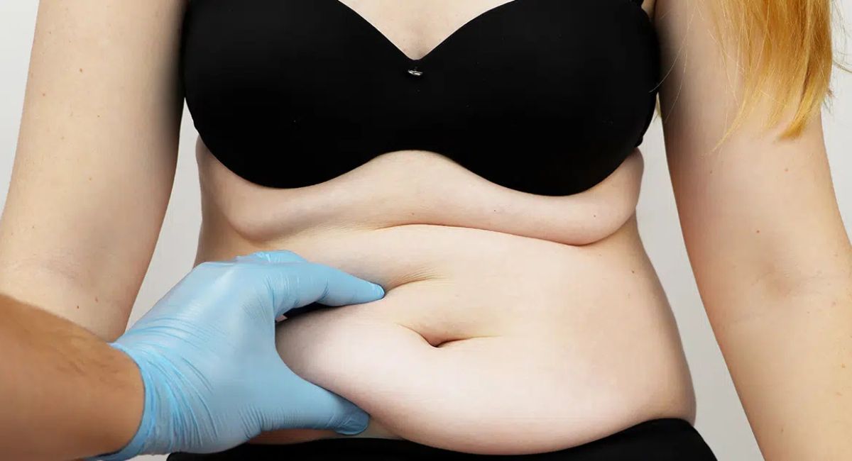 get-rid-of-apron-belly