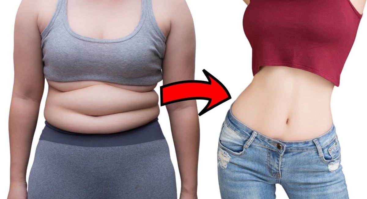 preventing-apron-belly-after-weight-loss